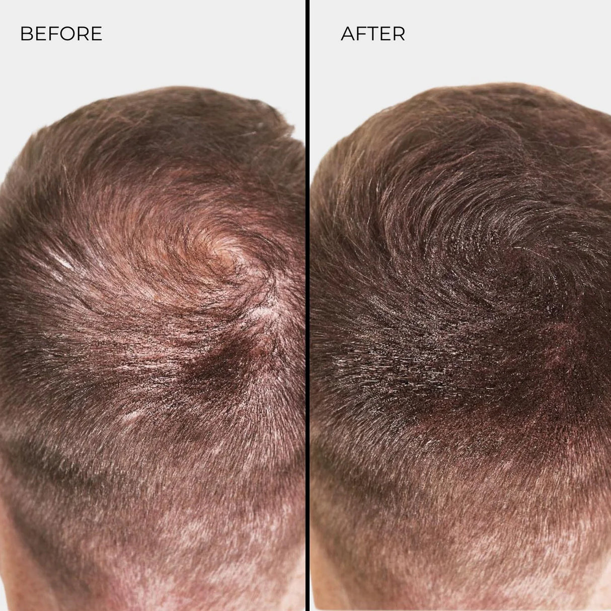 Nanogen Włókna zagęszczające włosy Kasztanowy