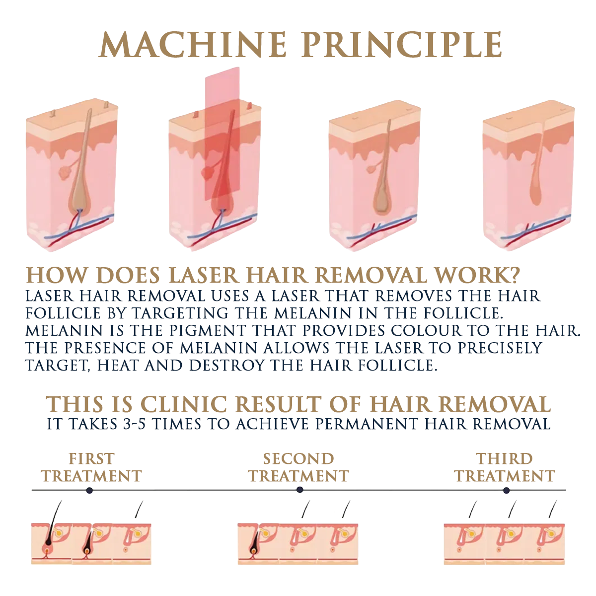 Skin Monarch Qantum Pro Laser diodowy i pikosekundowy 