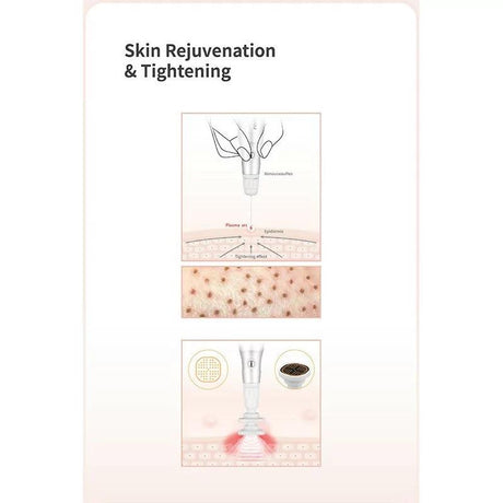 BOMTECH Renouveau Plasma Pen - BVShop