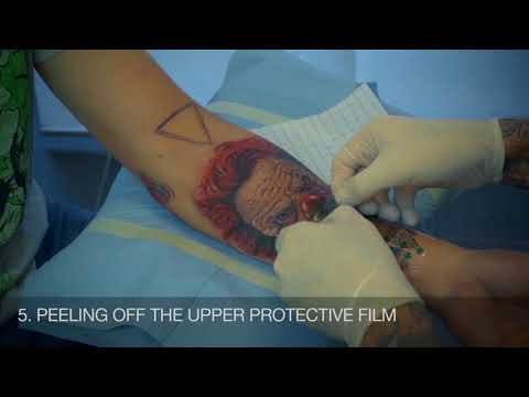 Dermalize Pro Rolka 15 cm x 10 m